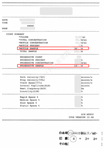 精液検査　精子提供バンク東京関東　精子ドナー